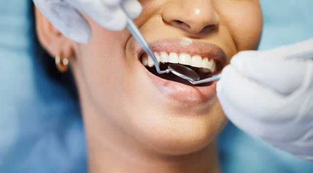 Best Emergency Dental Services for Seniors in Saratoga Springs, UT